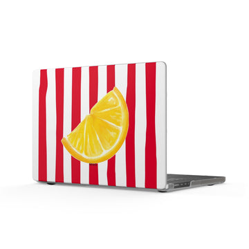 Hotlime Matte MacBook Case — Slim Protective Laptop Cover
