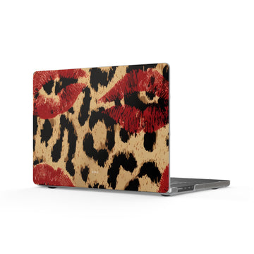 Lip Service Matte MacBook Case — Slim Protective Laptop Cover