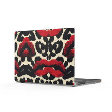Poison Kiss Matte MacBook Case — Slim Protective Laptop Cover